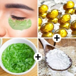 Dark circles