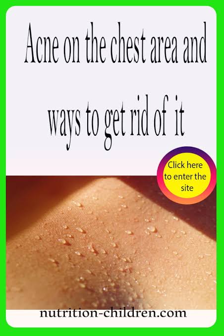 Acne on the chest area and ways to get rid of