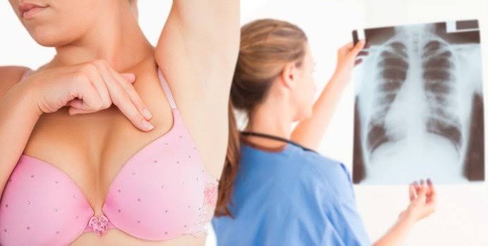 Breast changes that tell you about your health