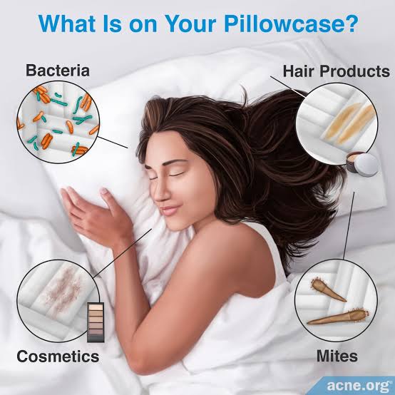 How do pillowcases affect the skin?