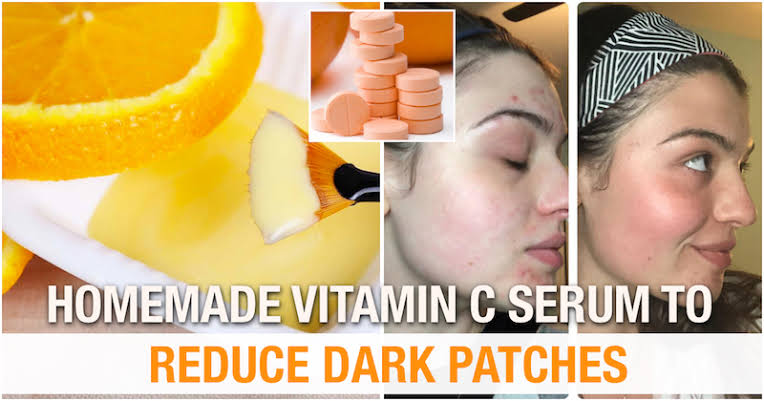 Make a vitamin C serum to take care of your skin