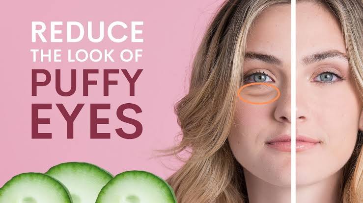 Get rid of puffy eyes in minutes