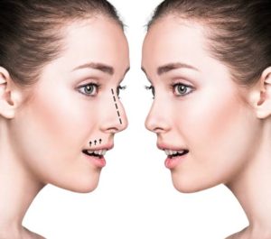 Plastic surgery
