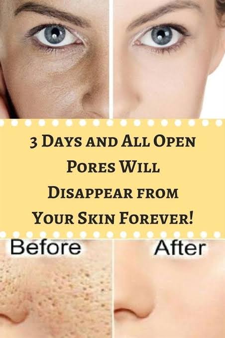 Prepare a toner to eliminate large pores