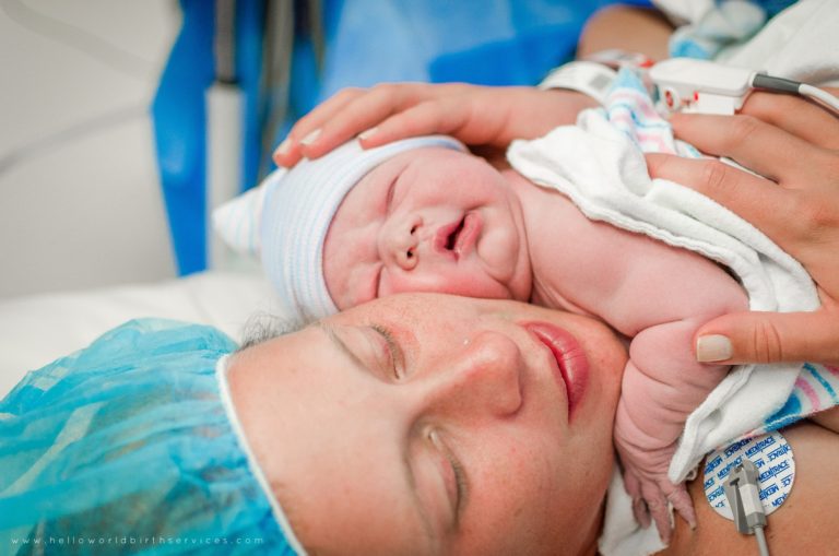 gentle-cesarean-birth