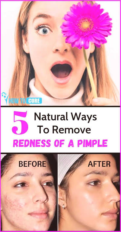 How to get rid of redness of pimples