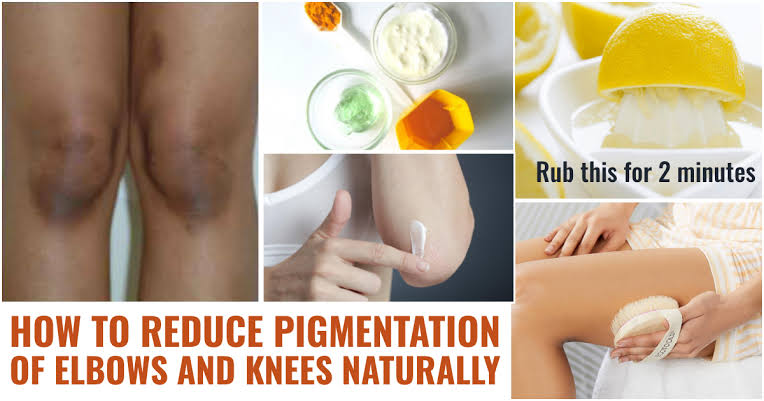 Treating darkening of the knee is easier with these recipes
