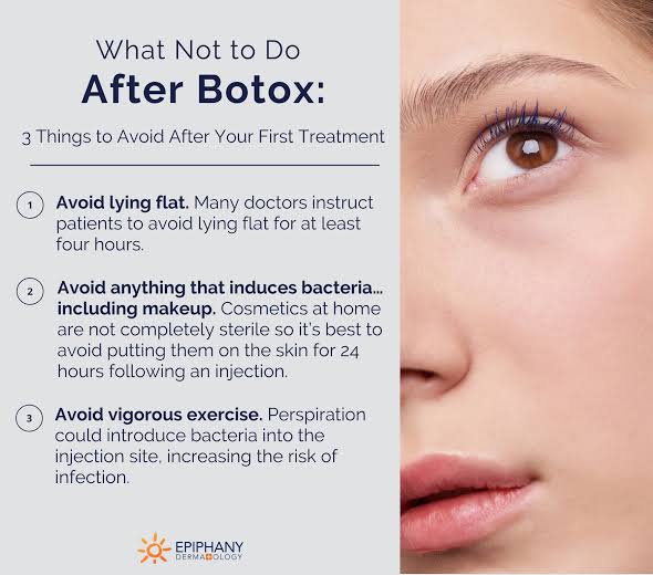 5 things to avoid after Botox treatment
