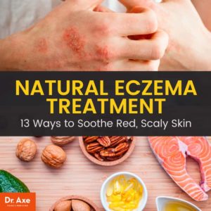 Eczema-ArticleMeme