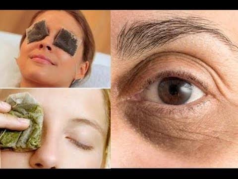 I brought you a natural solution that will remove dark circles