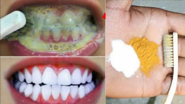 Get whiter teeth like stars without whitening