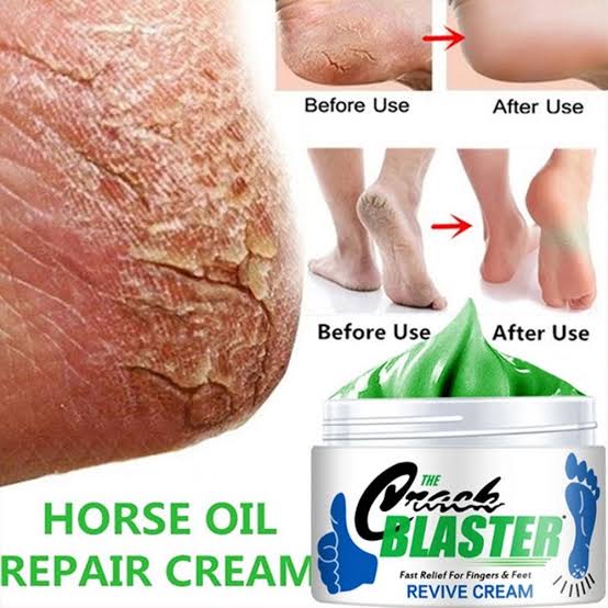The easiest way to treat rough feet and hands and get rid of cracks with them