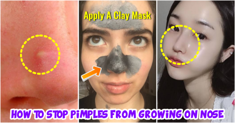 Facebook-Collage-—-05-Pimple