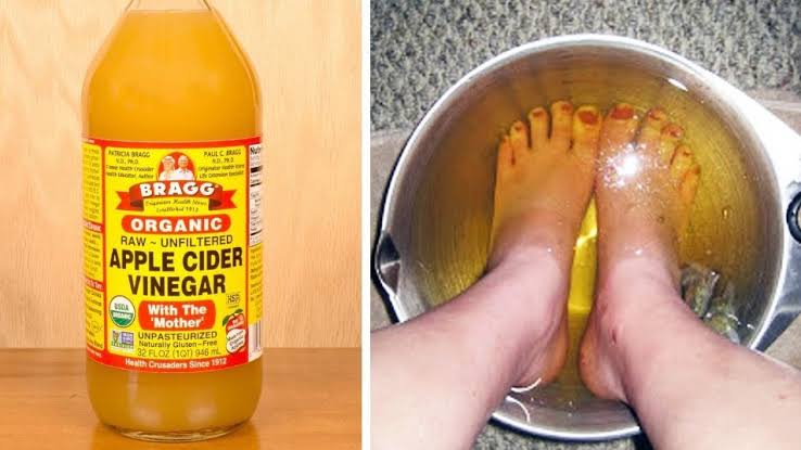Put your hands twice a week in an apple cider vinegar soak and notice the amazing result!