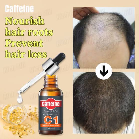 How do we use caffeine to treat hair loss?