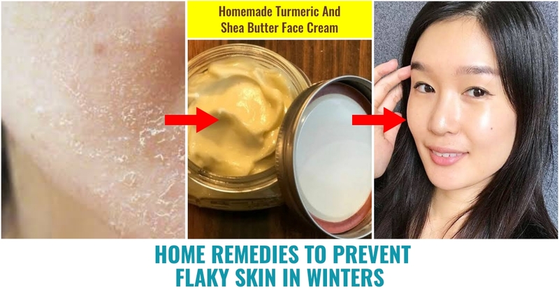 10 Home Remedies To Prevent Flaky Skin in Winters