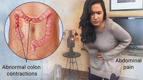 Cure Irritable Bowel Disease in 10 Minutes