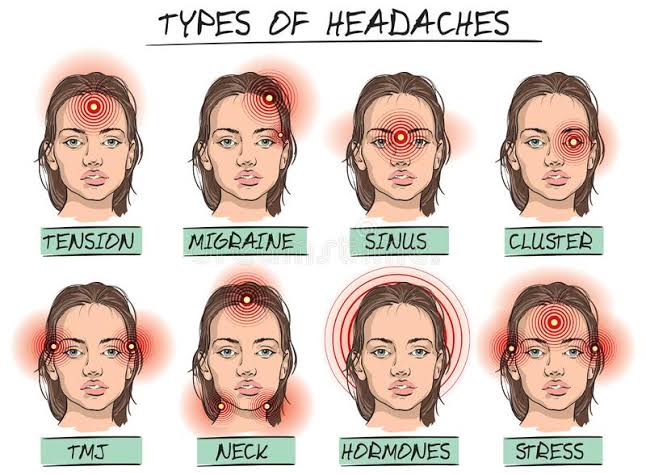 There are 8 types of headache, how do you differentiate between them?