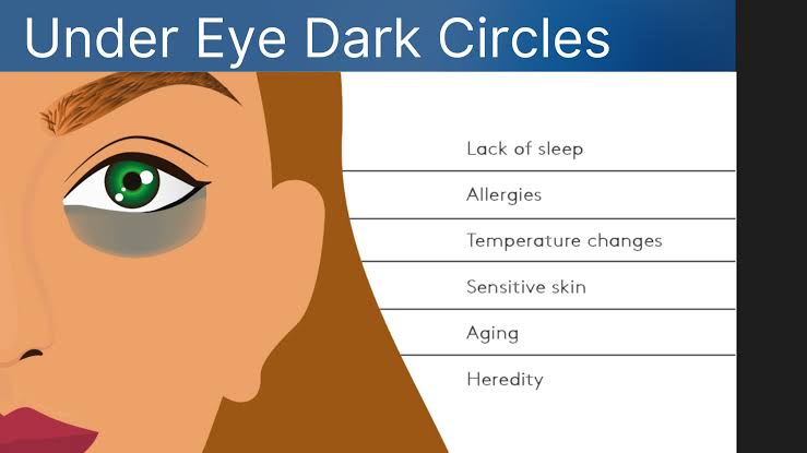 Causes and treatment of dark circles under the eye
