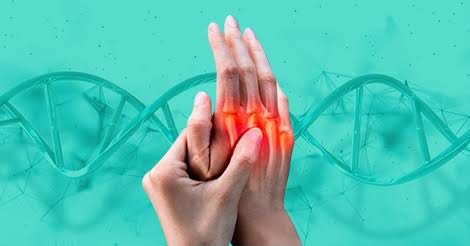 Rheumatoid arthritis treatment ‘may start from DNA’