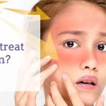 A great recipe for treating sunburn