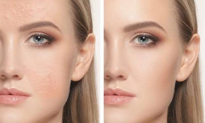 Reasons for uneven skin tone