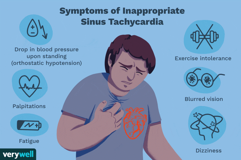 inappropriate-sinus-tachycardia-1745220-v1-549ea837eb4f4c7d94feef0f732fe8bd