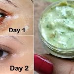 An Indian recipe to permanently get rid of wrinkles around the eyes