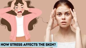 This is How Stress Affects Your Skin & What To Do About It