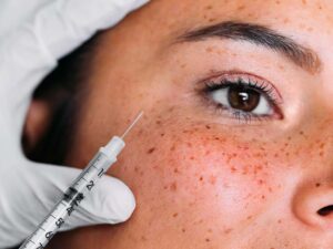 Botox and similar injections work by relaxing facial muscles to smooth out fine lines and wrinkles.