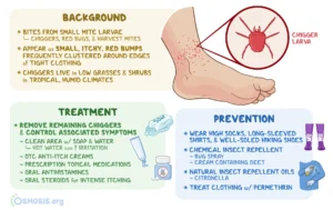 10 Effective Remedies for Chigger Bites (You Have at Home)
