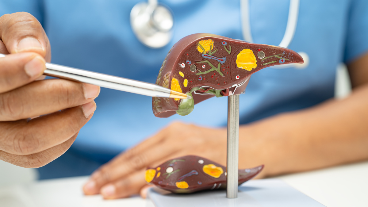 Non-alcoholic fatty liver disease: 3 medicinal plants that can help you