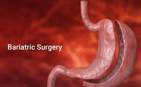Combined Bariatric Surgery and Liver Transplantation: Long-Term Health Benefits