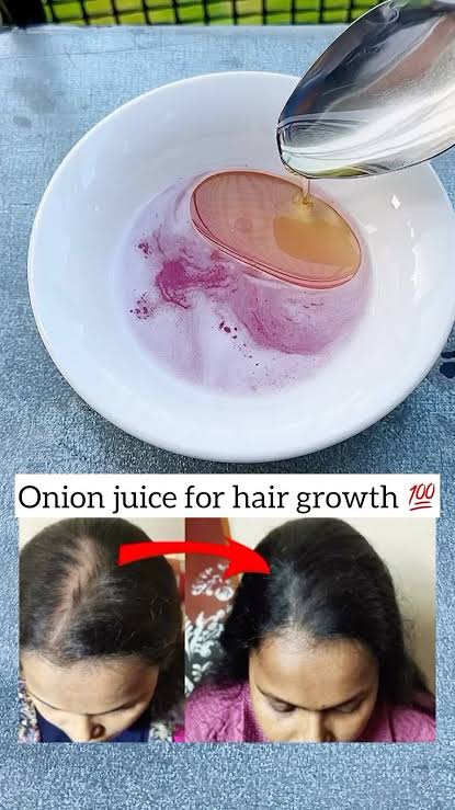 The Benefits of White Onions for Women Will Amaze You