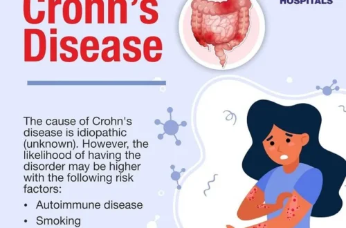 What Is Crohn’s Disease? Symptoms, Causes, and Treatment
