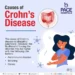 What Is Crohn’s Disease? Symptoms, Causes, and Treatment