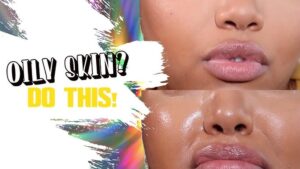 How to Treat and Prevent Oily Skin