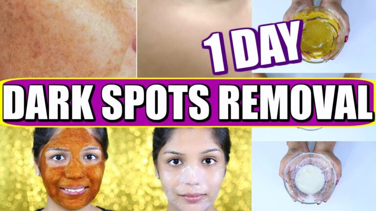 dark spots
