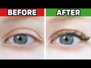 Why Are My Eyelashes Falling Out?